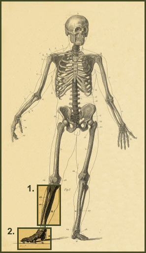 Bone
Infection Case Studies