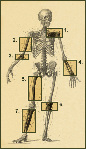 Complex Fracture Case Studies