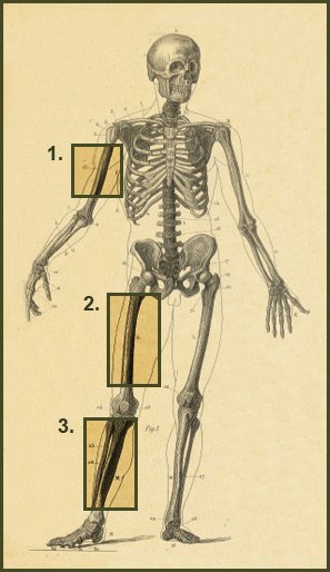 Llimb Lenghthening