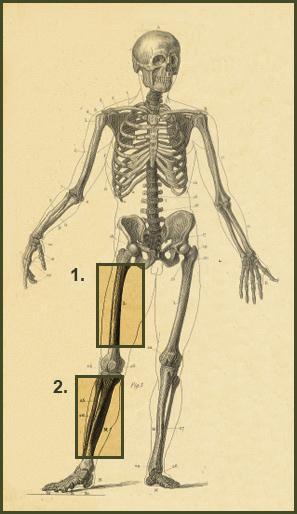 Periprostetic Fractures Nonunion Case Studies